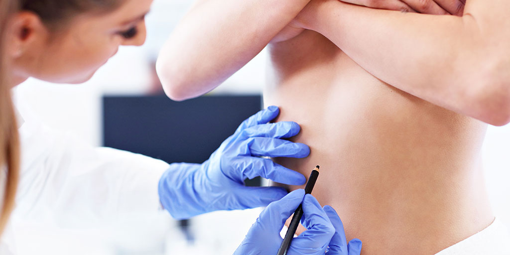 Plastic surgeon marking patient