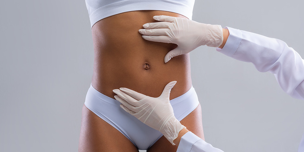 Tummy Tuck Surgery (Abdominoplasty): What it is & Who is the Right