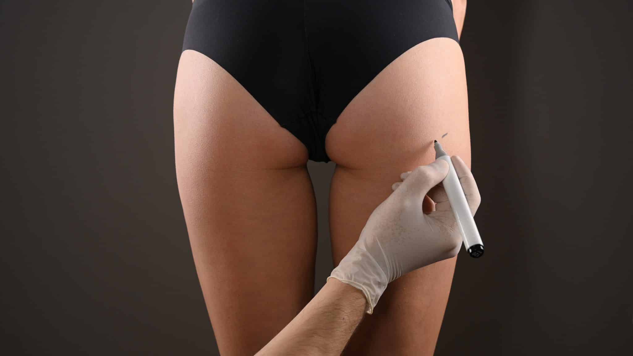 Tighten & Firm Loose Buttocks