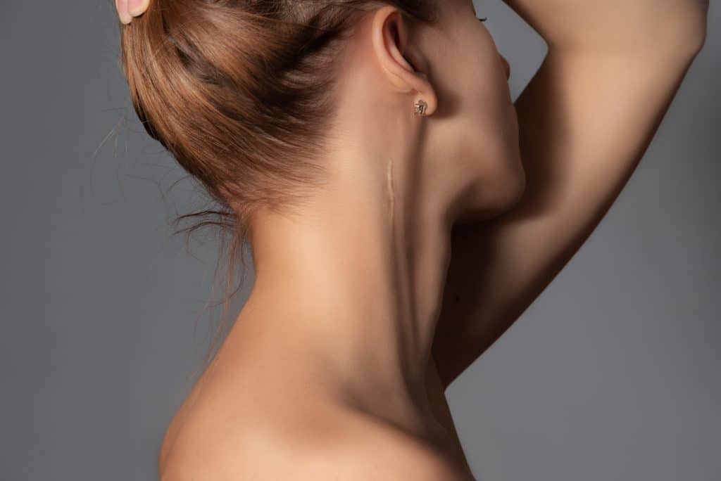 Close-up of a woman with her hair tied up, revealing a faint scar running vertically along the side of her neck.