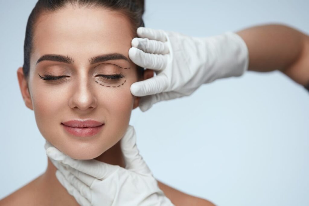 Close-up of a woman with dotted lines around her eyes, indicating areas for eyelid surgery, as a surgeon’s gloved hands gently position her face.