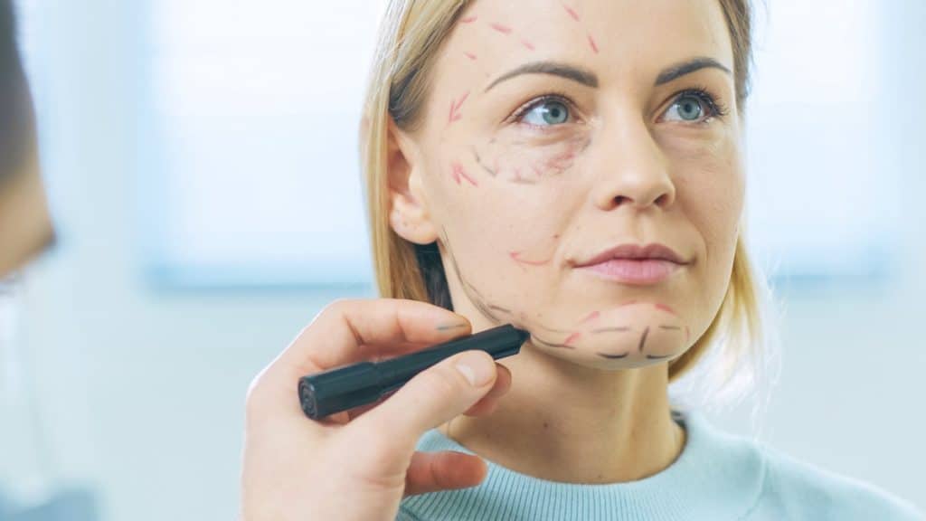 Woman with facelift markings during consultation; surgeon marks areas for facial rejuvenation