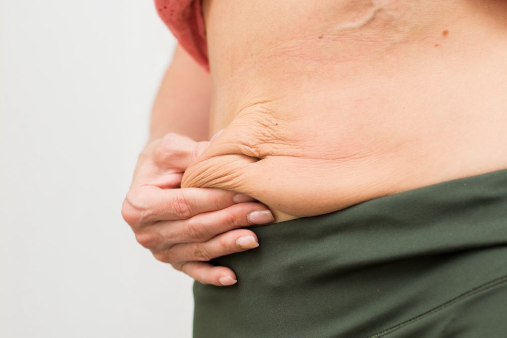 A person pinching loose skin and fat on their abdomen, wearing green pants and a red top.