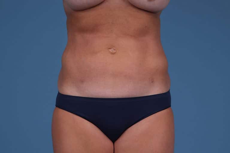 Person wearing dark underwear, shown from shoulders to hips, standing against a plain blue background.