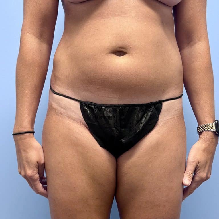 Person standing against a blue background, wearing a black disposable undergarment, showing tan lines on hips and waist.
