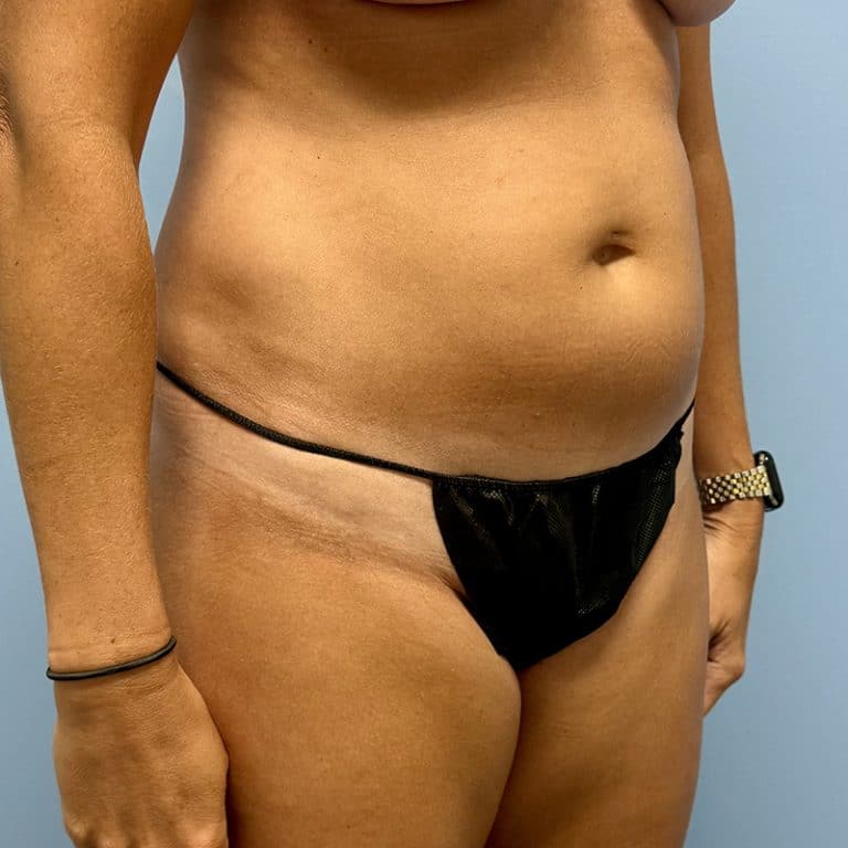 Woman in black bikini bottom with visible tan lines, standing against a blue background, midsection in focus.